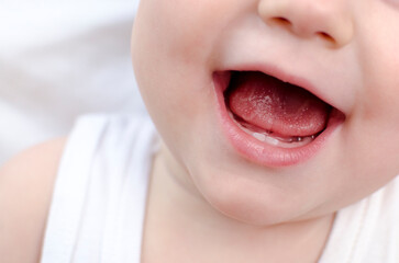 Fototapeta premium Baby mouth close-up. Infant primary dentition. Children healthcare and soothing concept