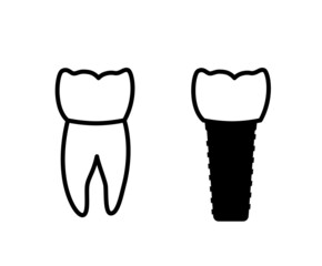 Dental implant procedure