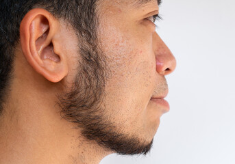 Side view of Asian man face with beard grows on a part of his face. Beard is the collection of hair...