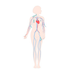 Central venous catheter placement sites shown on the female body. Types of central lines. Woman with CVC access devices. PICC, arterial line, implanted port for infusion. Medical vector illustration. - obrazy, fototapety, plakaty