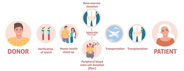 Bone marrow donation medical poster info graphic - obrazy, fototapety, plakaty