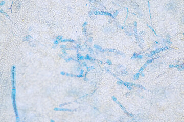 Slime molds, as a group, are polyphyletic under the microscope for education.
