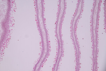 Slime molds, as a group, are polyphyletic under the microscope for education.

