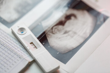 Fototapeta na wymiar positive pregancy test with ultrasound photo