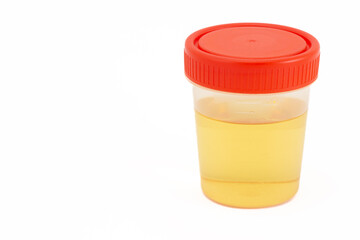 Full plastic jar with urine for medical tests isolated on white background. Urine sample in...