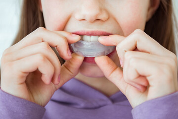 Child girl wearing myofunctional trainer. Help equalize the growing teeth and correct bite and corrects the position of the tongue