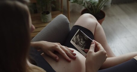 Relaxing pregnant woman holds ultrasound picture of her baby. The expectant loving mother caresses her baby in the tummy. Belly of a pregnant woman. Maternity prenatal care and pregnancy concept. - Powered by Adobe
