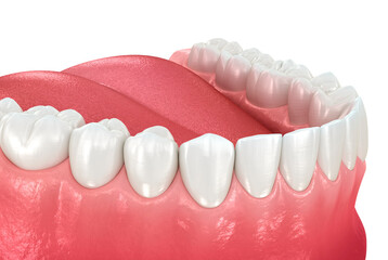 Healthy human teeth with normal occlusion. Dental 3D illustration