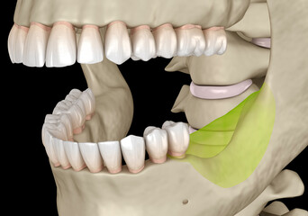Mandibular Jaw, bone recession after losing molars teeth. Dental 3D illustration