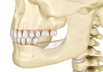 Mandibular Jaw, bone recession after losing molars teeth. Dental 3D illustration