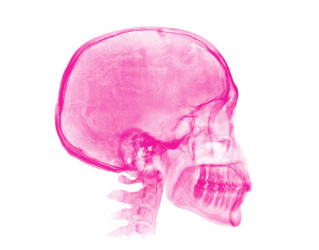 Human skull. Pink X-ray image on white background