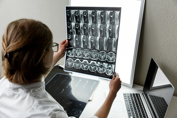 Doctor examining the result of cervical spine MRI.