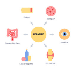 Autoimmune hepatitis disease - obrazy, fototapety, plakaty