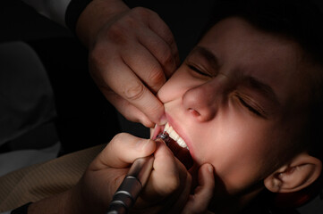 Visiting a dentist, brushing a tooth with a drill, a schoolboy at a pediatric dentist.