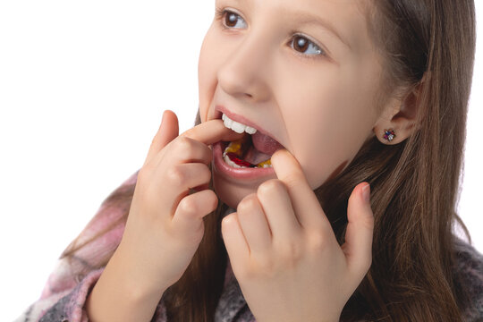 A cute little girl is putting on an orthodontic appliance. The concept of oral hygiene in childhood. Studio photo on a white background.
