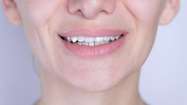Perfect white teeth close up, female veneer smile, dental care and stomatology, dentistry