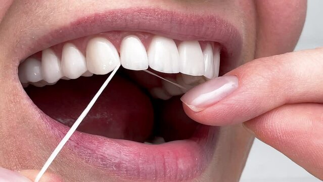 Closeup woman flossing perfect white teeth with floss toothcare hygiene, teeth cleaning routine and cavity prevention, female veneer smile, dental care and stomatology.