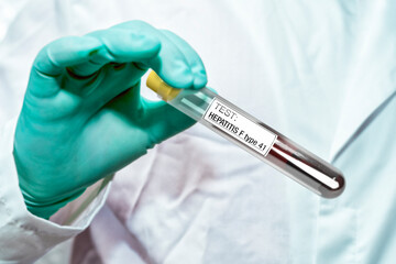 Background on the theme of a new variant of the hepatitis virus. Hand of a doctor in a glove with blood tests with the inscription HEPATITIS F type 41.