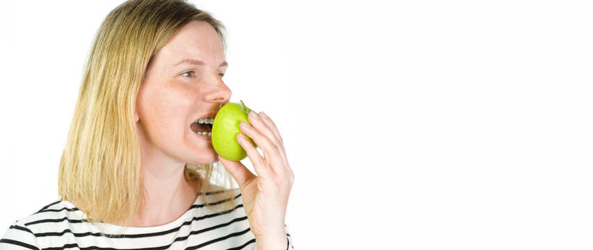 Young woman with dental braces biting green apple isolated light background. Studio. Cute lovely girl with metal braces on white clear teeth smiling in clinic. Close Up. Positive Emotion. Stomatology