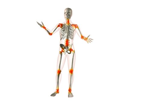 X-ray view of a human skeleton with joint inflammations