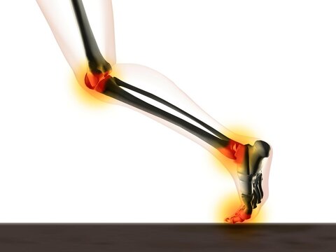 X-ray view of a human's leg showing pain in knee, ankle and foot in running position