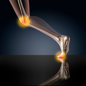X-ray view of a human's leg showing pain in knee and ankle in running position
