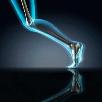 X-ray view of a human's leg in running position