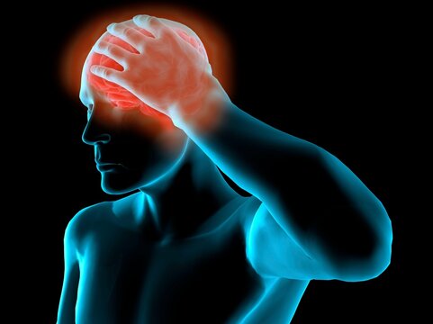 X-ray view of a man grabbing his head in pain