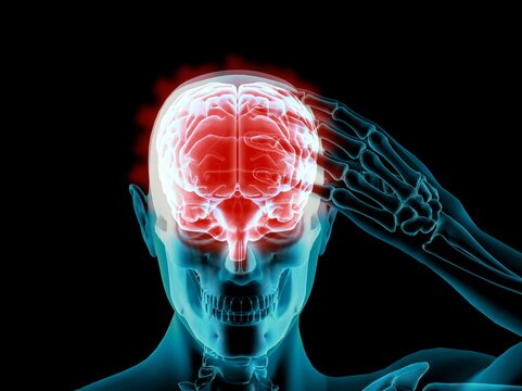X-ray view of a man grabbing his skull in pain