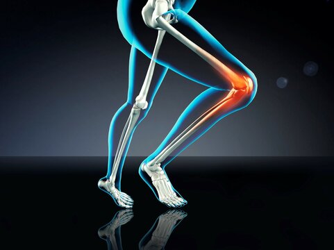 Blue X-ray of woman's knee pain while running on dark blue background