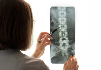 Female doctor holds and examines spinal column scan against background of light screen. Radiologist...