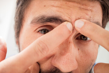 Hispanic guy messing around with a black head on his forehead