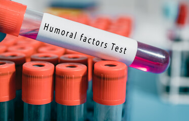 Thymus Humoral factors Test Helps develop the lymphoid system