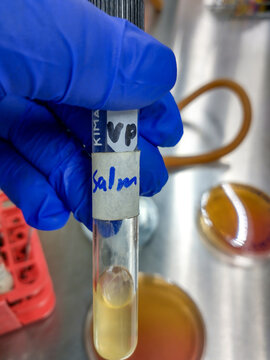 Test a bacteria Salmonella en Medio Voges Proskauer
