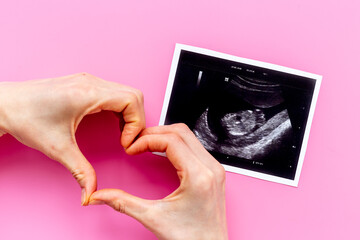 Womans hands holding ultrasound scan of unborn baby. Pregnancy background