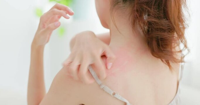 woman scratches her back