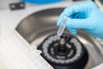 Female scientist in protective gloves picks up samples from the centrifuge and puts into the rack....