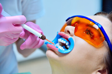 Woman dentist applies whitening gel to patient teeth