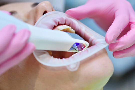 Dentist hands in pink gloves scaning patient's teeth