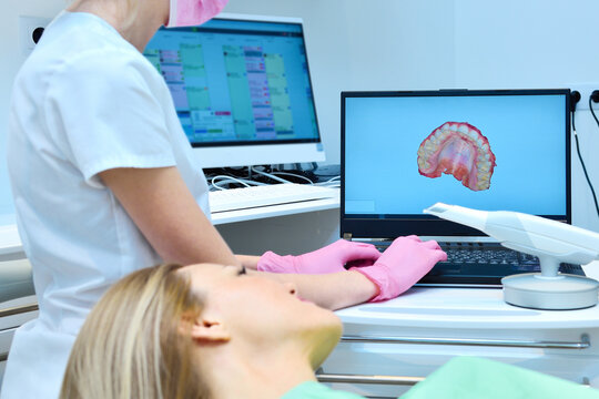 Woman dentist shows on laptop screen at dental 3d scan jaw.