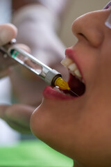 Vertical photo of a dentist injecting anesthesia into the mouth of a patient