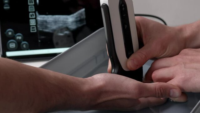Physiotherapist performing an ultrasound on a climber's finger to check for a pulley injury.