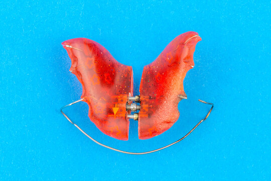 Orthodontic children's prosthesis in red on a blue background.