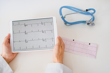 cardiologist holding the latest electrocardiogram of a patient with heart disease arrhythmia myocardial infarction an compare with old one on a tablet.