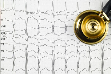 Layout: on the table, an ECG with rhythm disturbance, a stethophonendoscope.