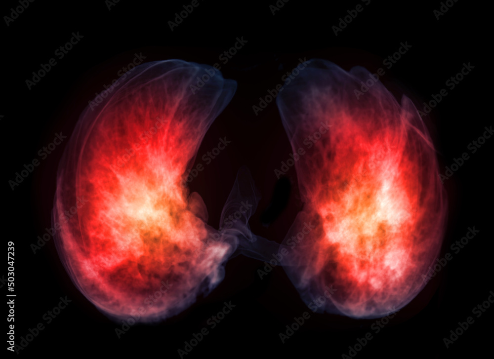 Poster base of lung 3d rendering image.