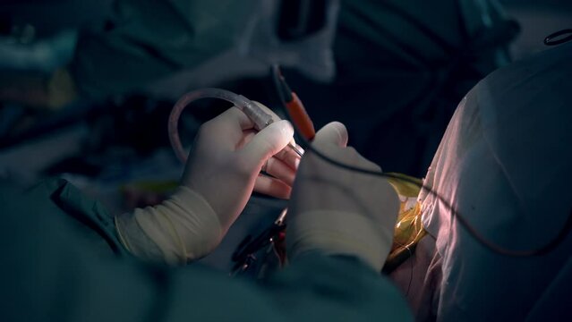Hands of a doctor in latex gloves hold instruments moving them in the operated area. Surgeon working in the dark operational room.