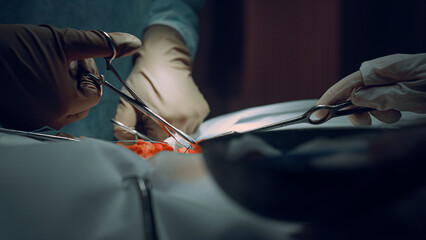 Closeup surgeon hands stitching wound after successful operation in clinic.