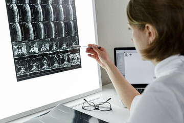 Doctor examining the result of lower spine MRI