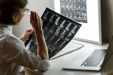 Doctor examining the result of lower spine MRI
